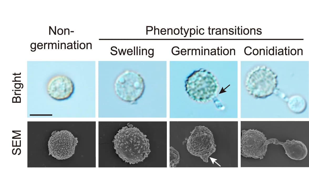 Open access visualization of Microscopy, Bright-field, SEM, Germination, Chlamydospores
