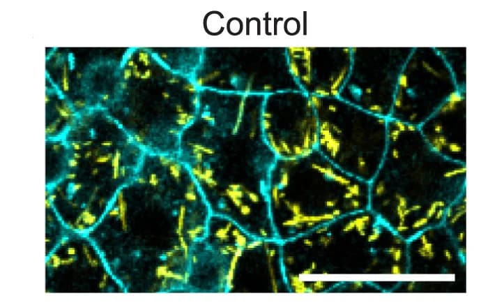 Open access visualization of Microscopy, E. Coli, Bacterial Injection, GPI-GFP Embryos, Controls
