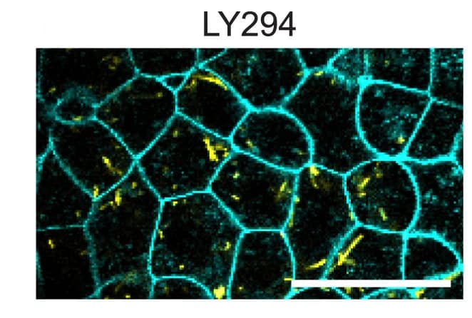 Open access visualization of Microscopy, E. Coli, Bacterial Injection, GPI-GFP Embryos, LY294 Treatment