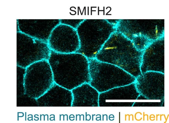 Open access visualization of Microscopy, E. Coli, Bacterial Injection, GPI-GFP Embryos, SMIFH2 Treatment
