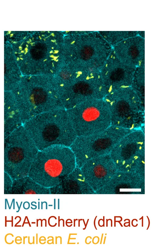 Open access visualization of Microscopy, Z-Projection, Impaired Uptake, H2A-mCherry Cells