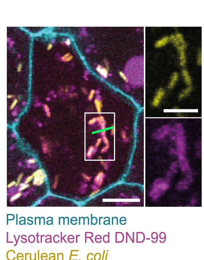 Open access visualization of Microscopy, Epithelial Cell, Lysosome, Ingestion
