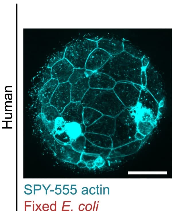 Open access visualization of Microscopy, Human Blastocyst, SPY555-Actin, E. Coli