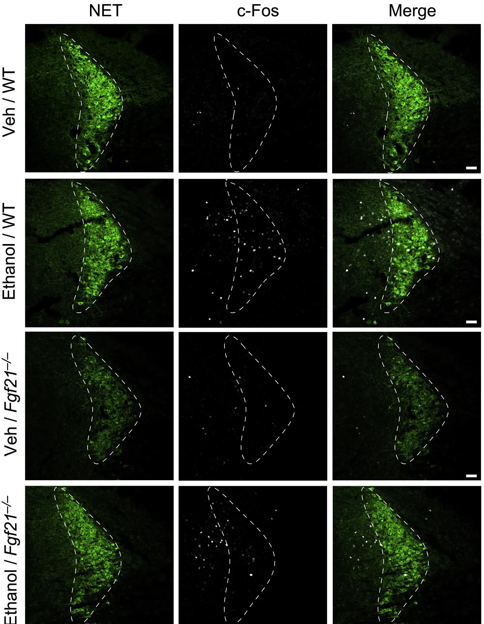 Open access visualization of Microscopy, Confocal Images, Immunostaining, c-Fos, Norepinephrine Transporter