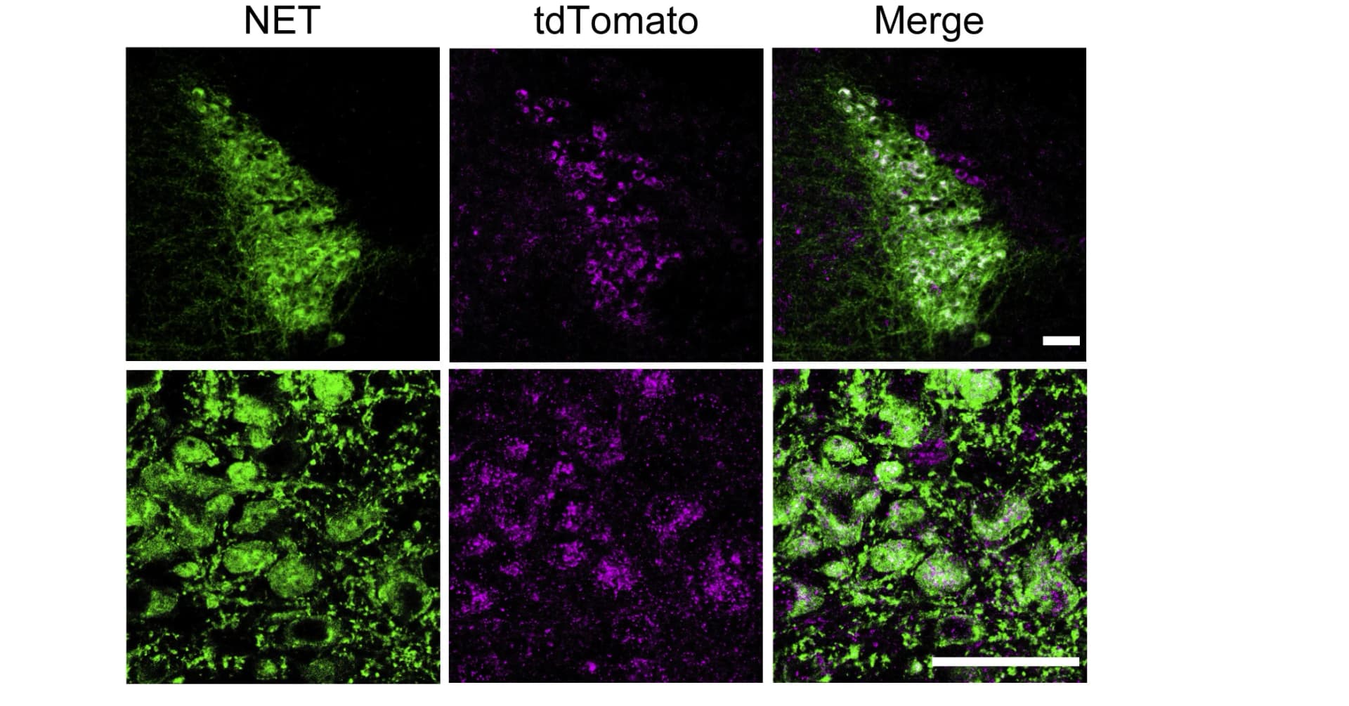 Open access visualization of Microscopy, Confocal Images, Immunostaining, Locus Coeruleus, Transgenic Mice
