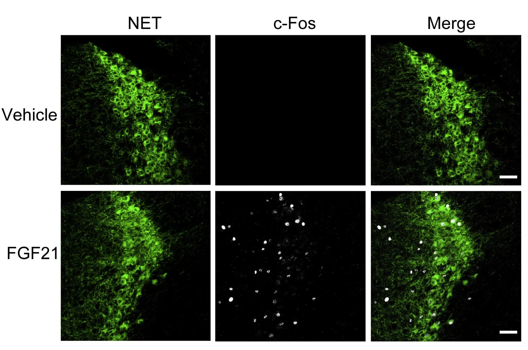 Open access visualization of Microscopy, Immunostaining, c-Fos, Norepinephrine Transporter, Locus Coeruleus