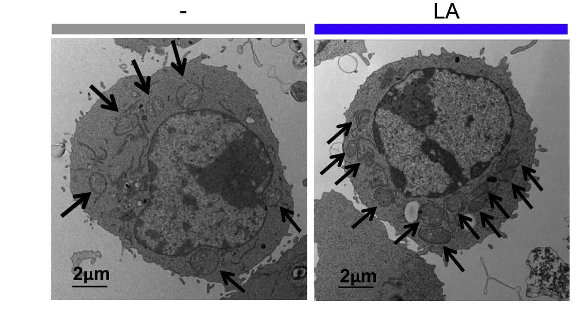 Open access visualization of Microscopy, TEM, Mitochondrial Mass