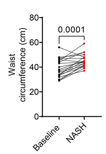 Open access visualization of Scatter Plot, Waist Circumference, NASH Diet, Baseline