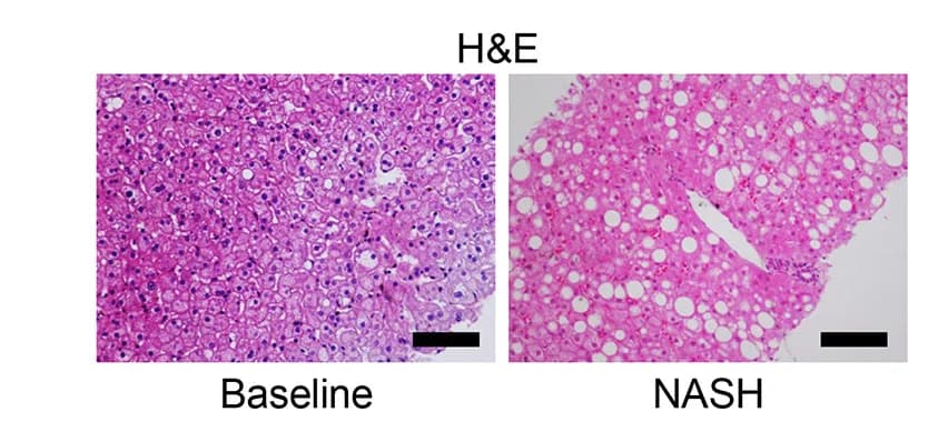 Open access visualization of Microscopy, Histology, H&E Staining, NASH Diet, Baseline