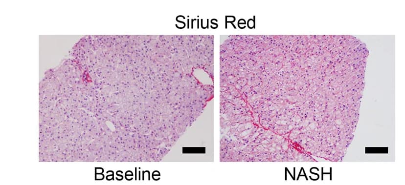 Open access visualization of Microscopy, Histology, Sirius Red Staining, NASH Diet, Baseline