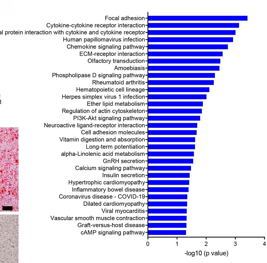 Open access visualization of Bar Plot, Pathways, Downregulated DEGs, Enrichment Analysis