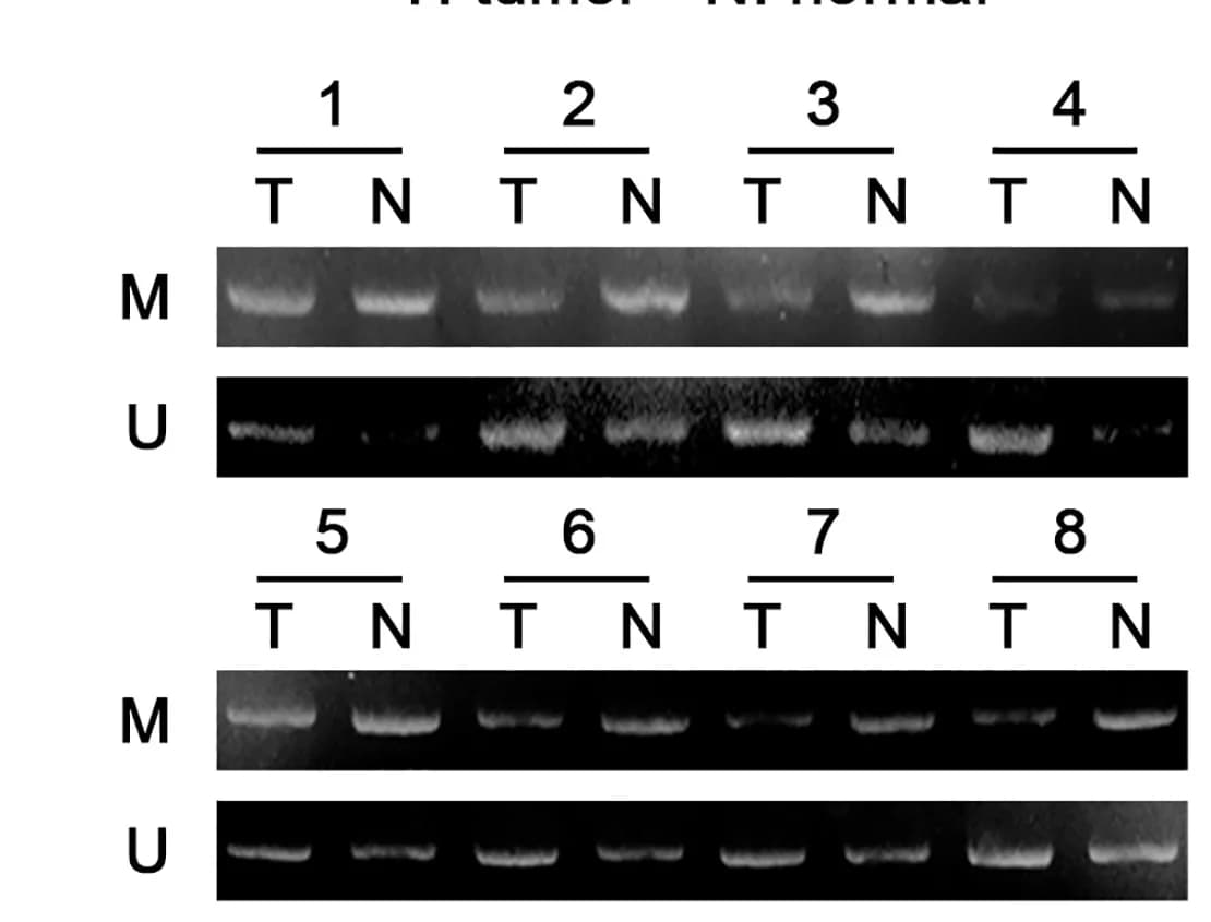 Open access visualization of Gel, TK1 Methylation Levels, HCC Tissues, Adjacent Tissues, Methylation-Specific PCR