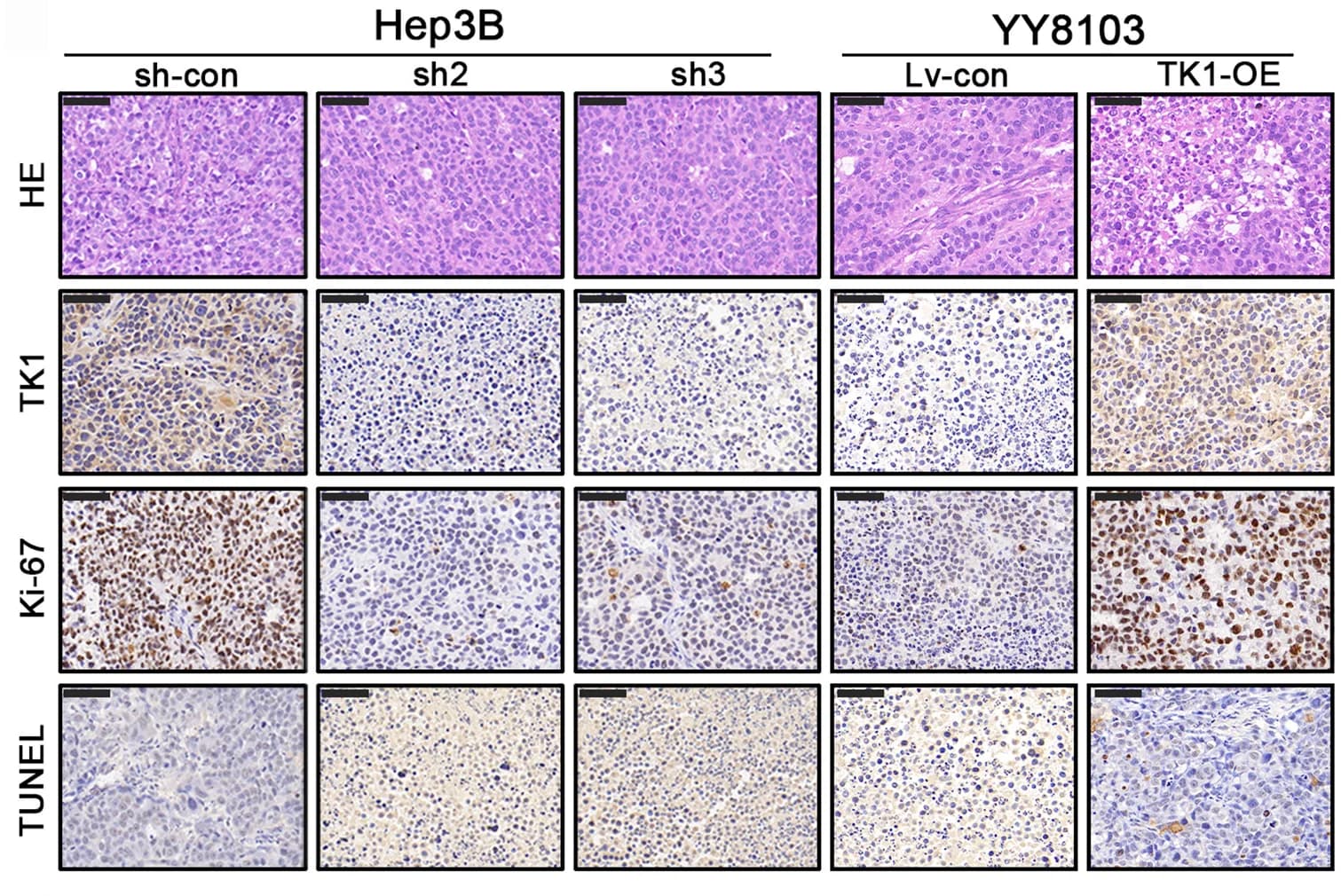 Open access visualization of Microscopy, H&E Staining, TK1 Immunostaining, Ki-67 Immunostaining, TUNEL Immunostaining