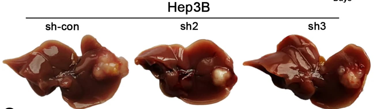 Open access visualization of Photo, Mouse Liver, Orthotopic Transplantation, Xenograft Tumors, Hep3B Cells