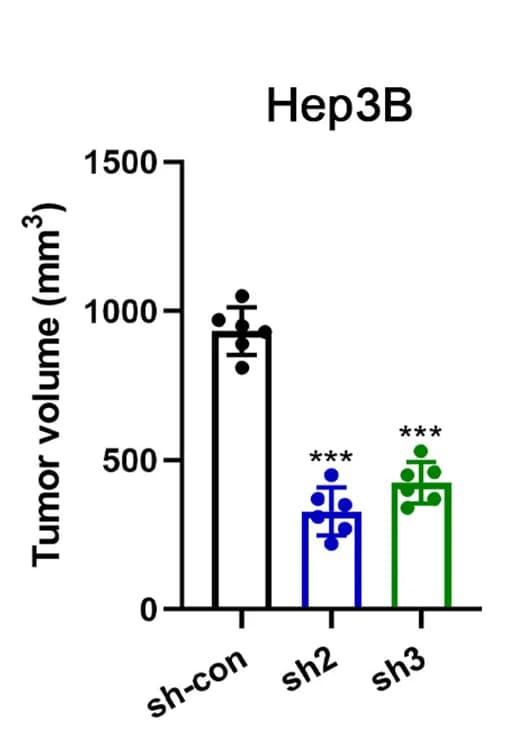 Open access visualization of Bar Plot, Error Bars, Orthotopic Implantation, Hep3B Cells, Tumor Volume