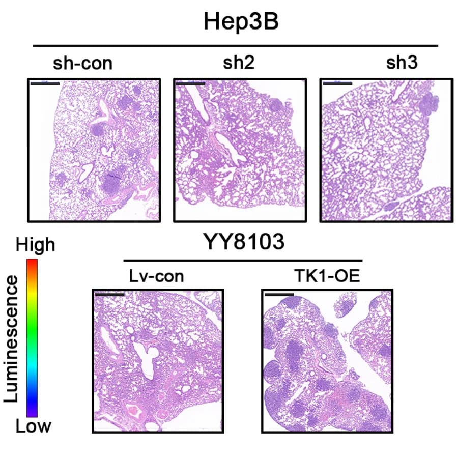 Open access visualization of Microscopy, H&E Staining, Lung Metastatic Nodules