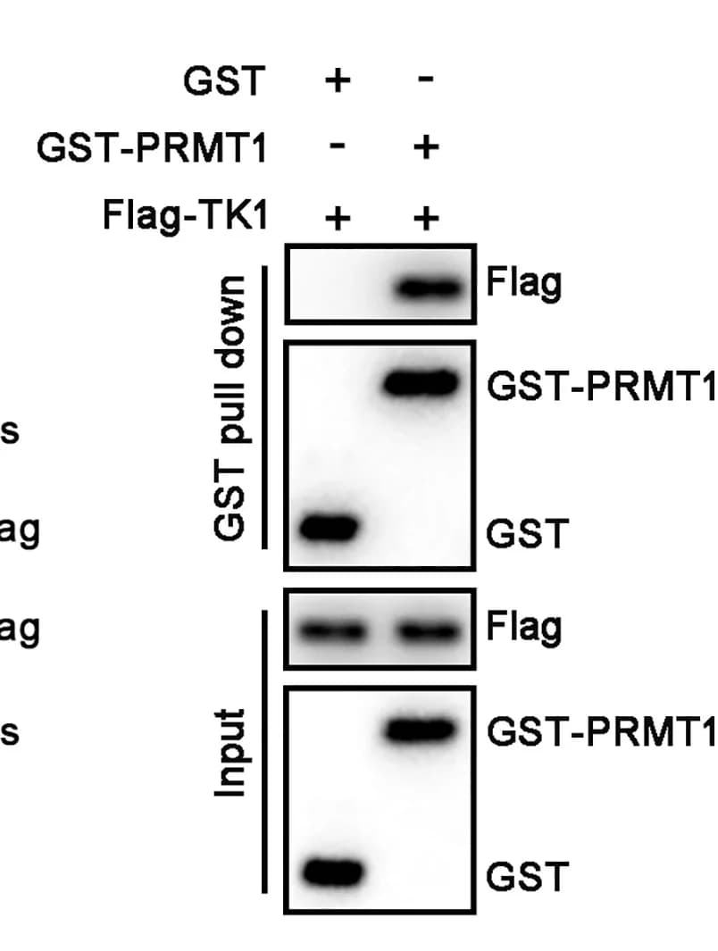 Open access visualization of Gel, Binding Analysis, TK1, PRMT1, In Vitro