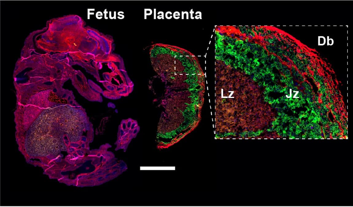 Open access visualization of Microscopy, Fluorescent Reporter, Placental Endocrine Zone, Transport Region, Maternal Decidua