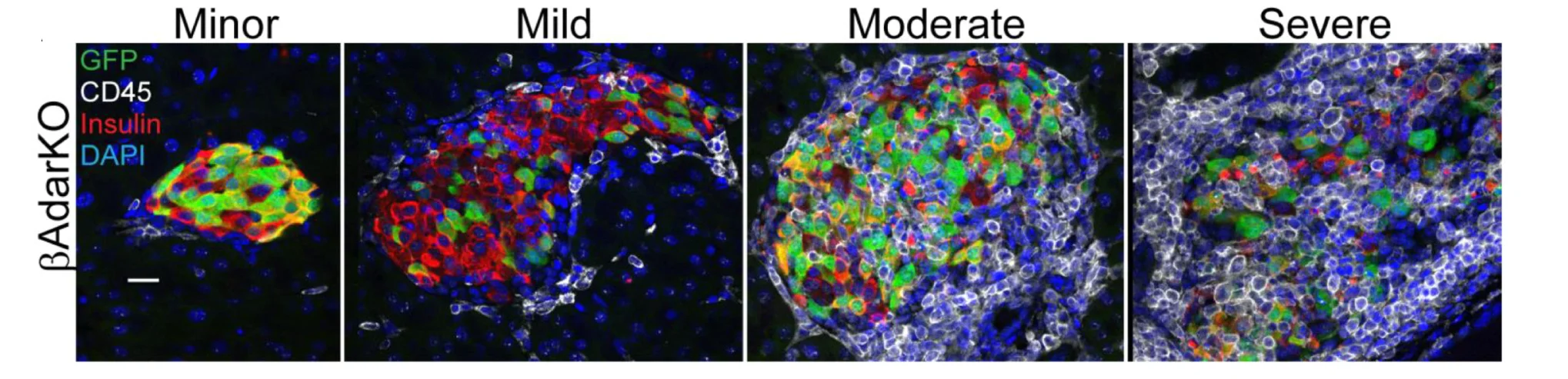Open access visualization of Microscopy, Islets, Inflammatory Infiltrates, Immunostaining, Insulin