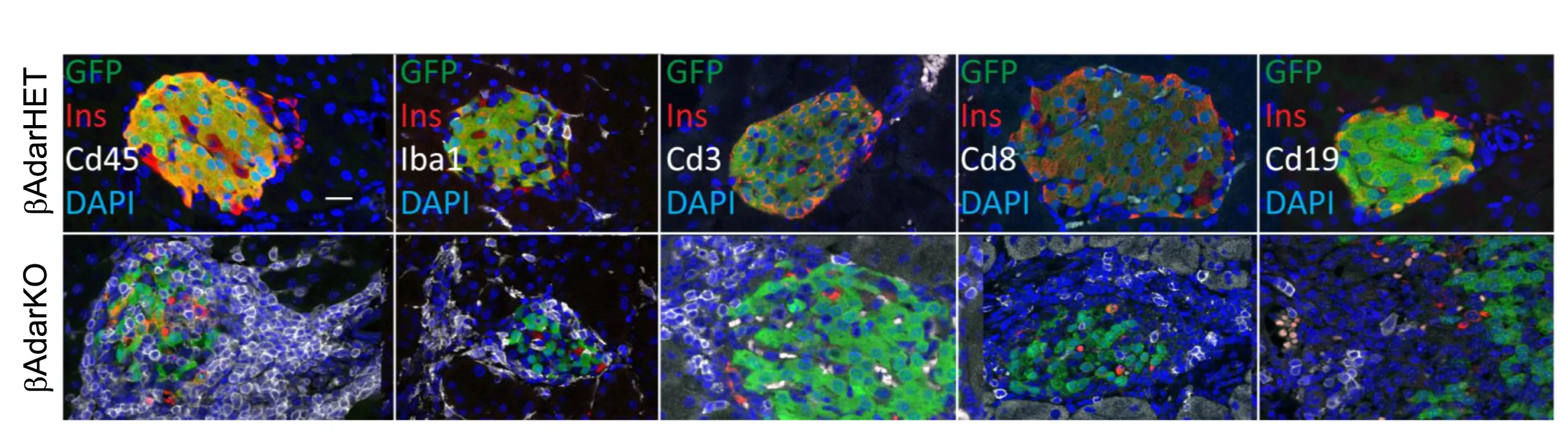 Open access visualization of Microscopy, Pancreas Sections, AdarHET Mice, AdarKO Mice, CD45