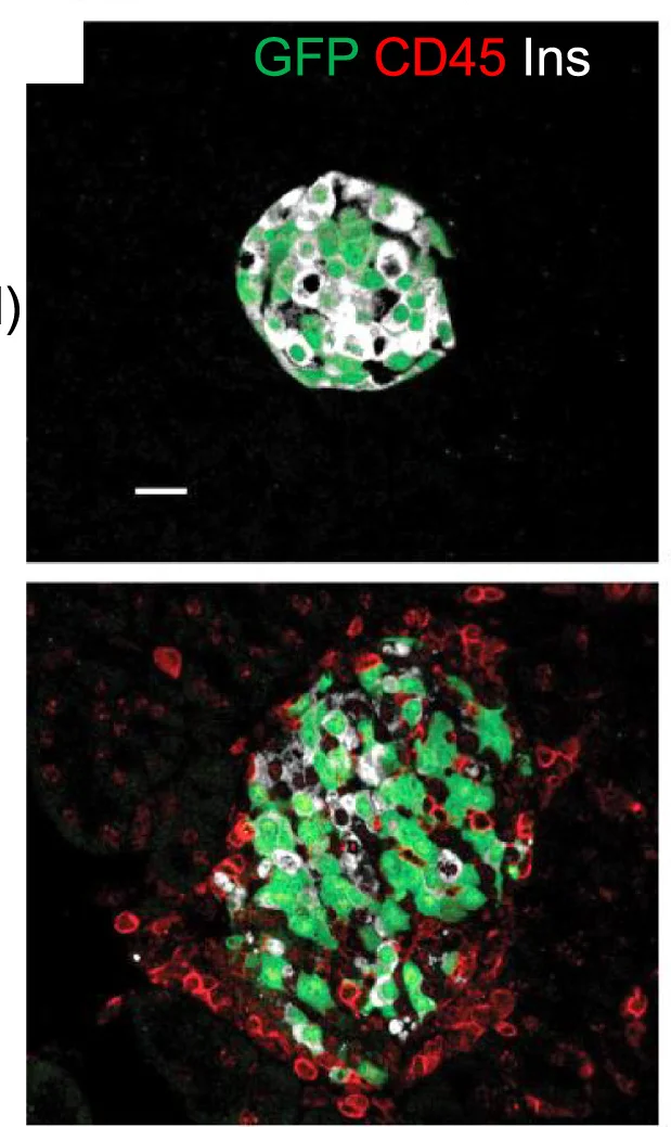 Open access visualization of Microscopy, Pancreatic Sections, BetaAdarKO Mice, GFP, Insulin