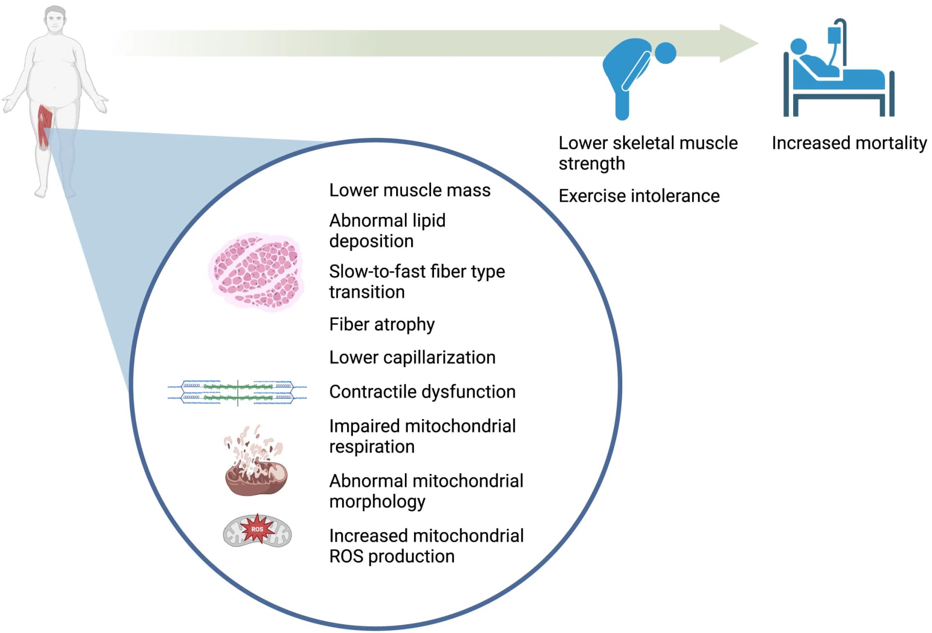 Open access visualization of Workflow, Illustration, Diabetes, Skeletal Muscle, Morphological Alterations