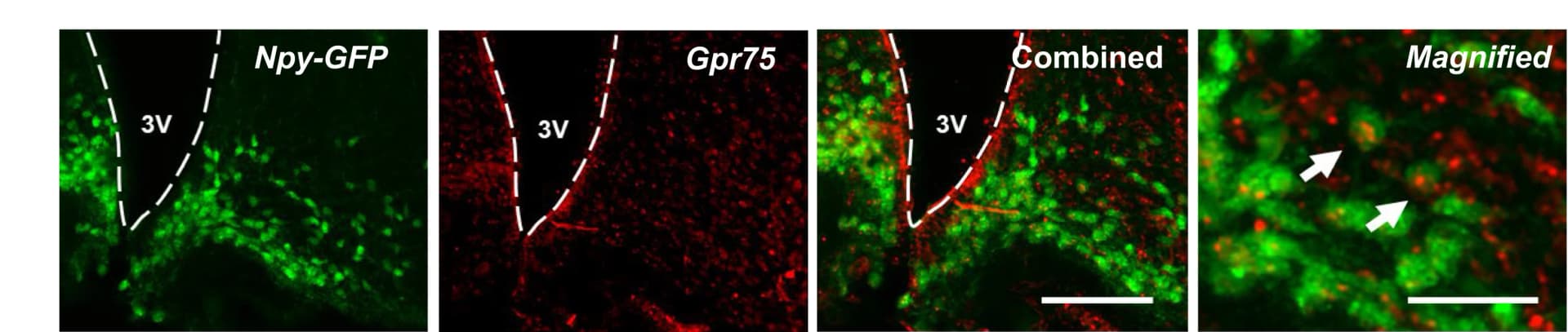 Open access visualization of Microscopy, Histological Validation, Co-expression, Npy/AgRP/GABA Neurons, Arcuate Nucleus
