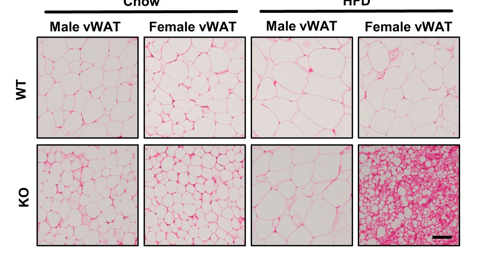Open access visualization of Microscopy, Oil Red O Histology, Visceral White Adipose Tissue, Gpr75 Knockout Mice, Wild-Type Mice