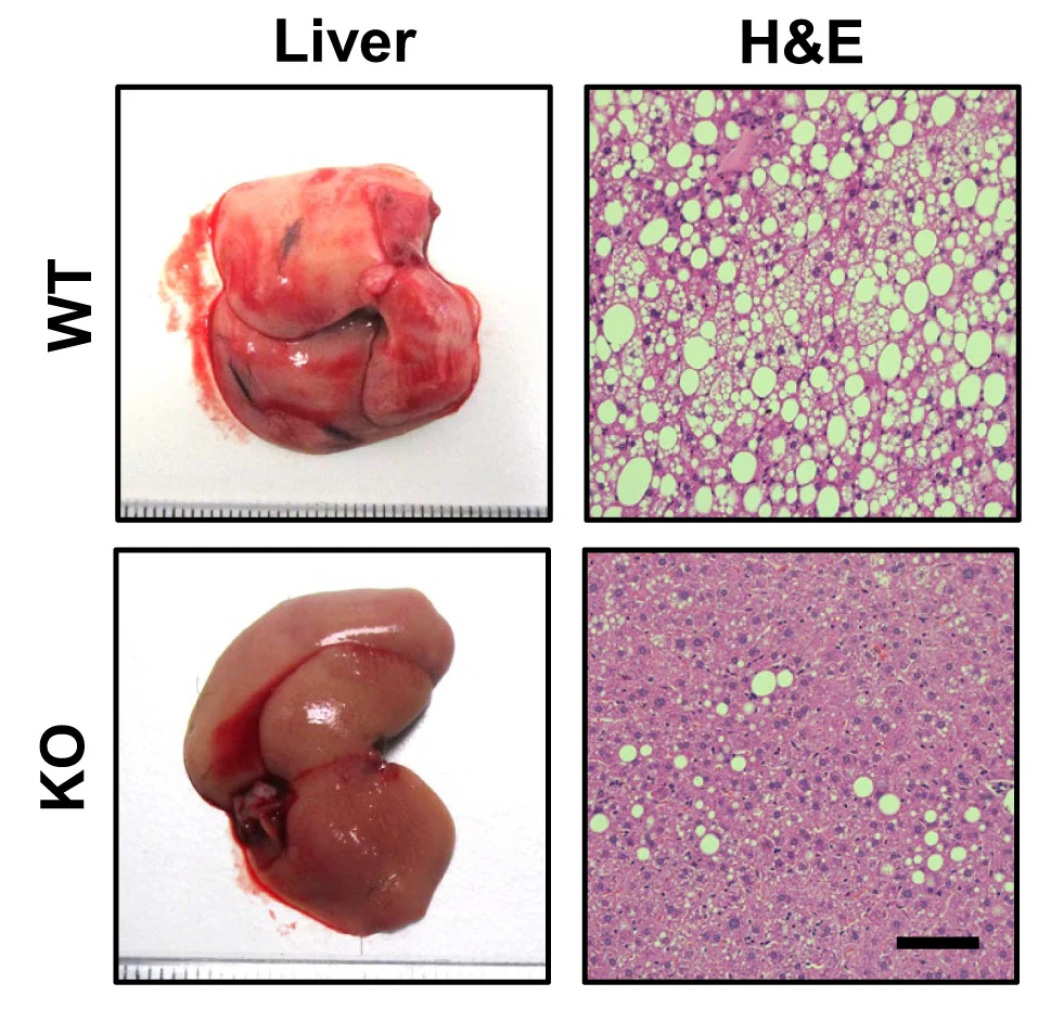 Open access visualization of Microscopy, Photo, Gpr75 Knockout Mice, Lipid Percentage