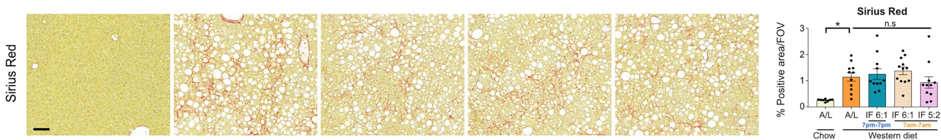 Open access visualization of Microscopy, Bar Plot, Error Bars, Immunohistochemistry, Sirius Red Staining
