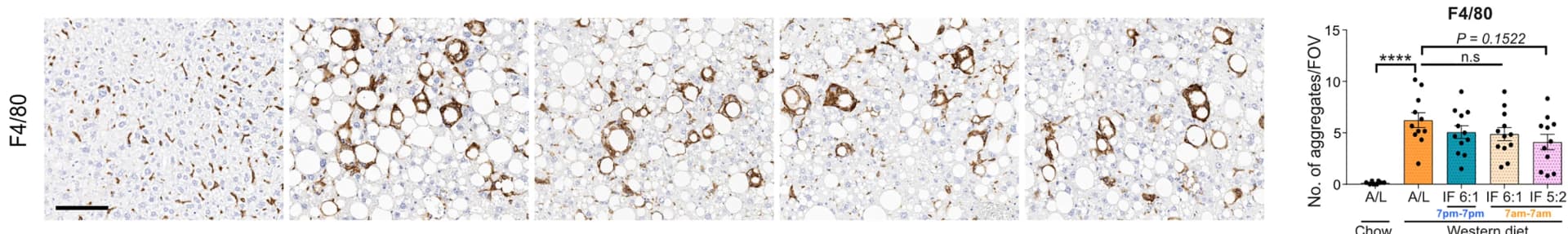 Open access visualization of Microscopy, Bar Plot, Immunohistochemistry, F4/80 Staining, Western Diet