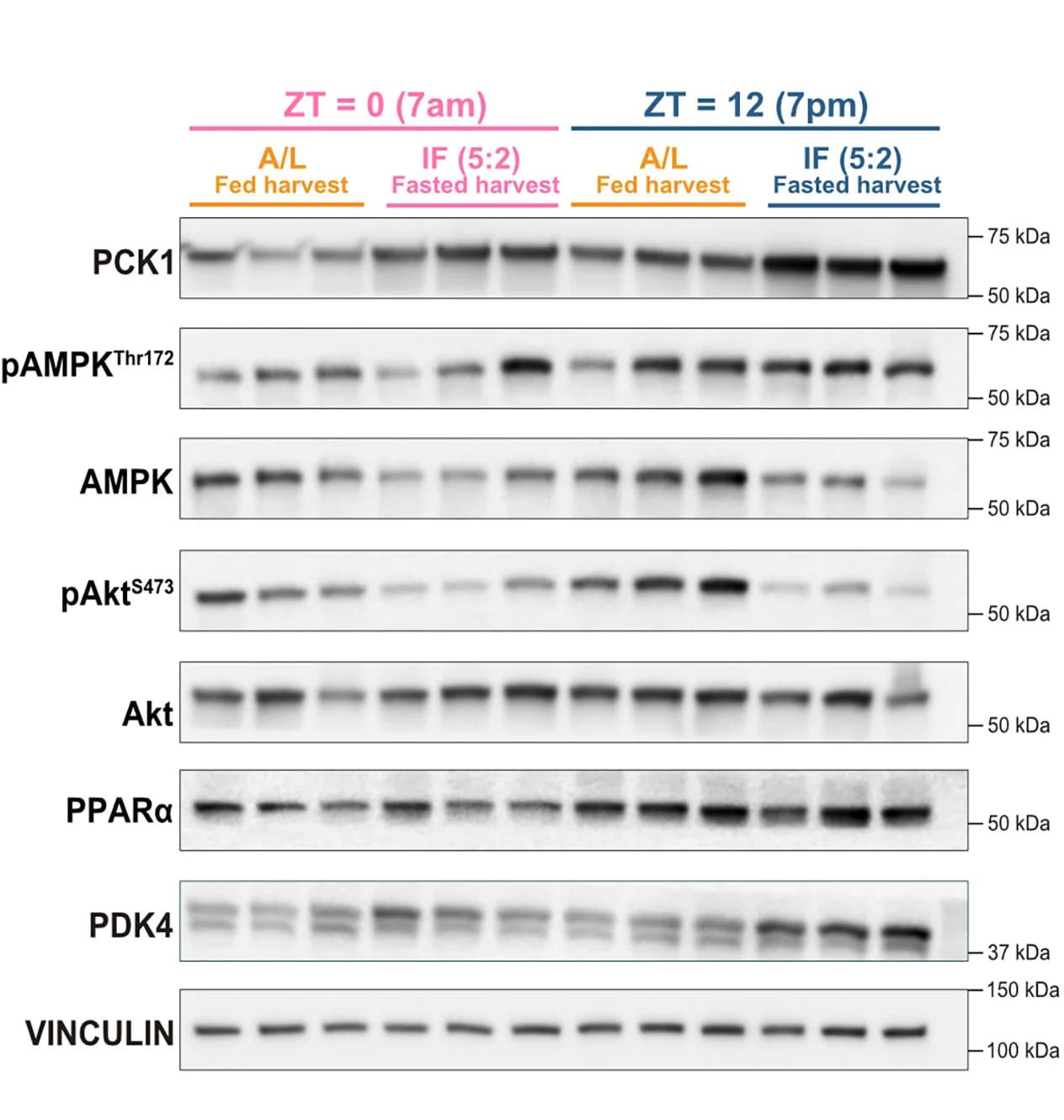 Open access visualization of Gel, Immunoblot, PCK1, pAMPKThr172, AMPK