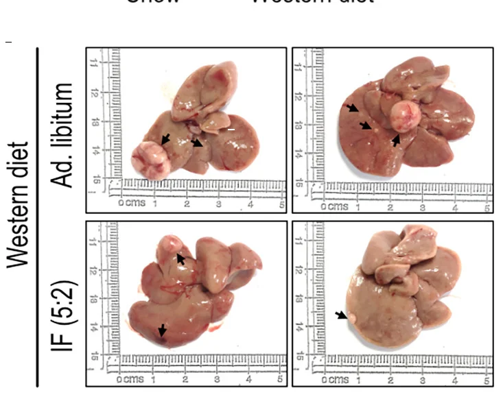 Open access visualization of Photo, Macroscopic Liver Photos, Western Diet, Choline-Deficient High-Fat Diet, CD-HFD