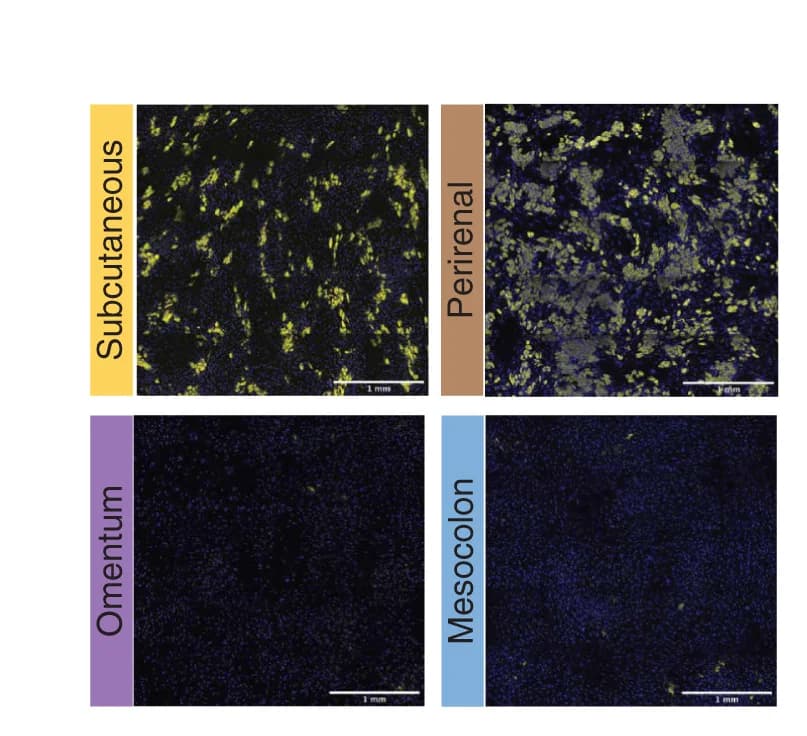Open access visualization of Microscopy, Fluorescence Microscopy, SVF-Adherent Cells, Differentiation, Lipids