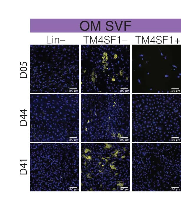 Open access visualization of Microscopy, Fluorescence Microscopy, OM SVF Lin- Cells, Lin-/TM4SF1- Cells, Lin-/TM4SF1+ Cells