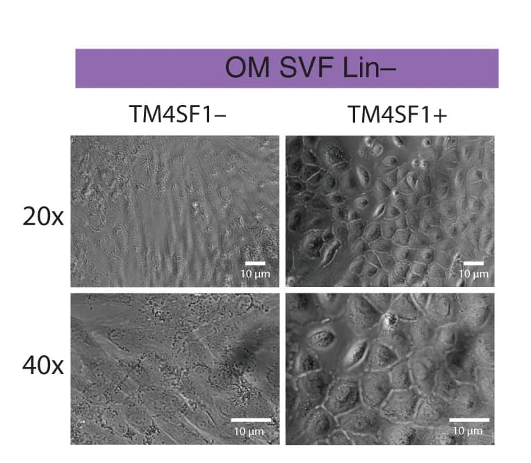 Open access visualization of Microscopy, Bright-Field Microscopy, Spindle-like OM hASPCs, Lin-/TM4SF1- Cells, Cobblestone-like TM4SF1+ Populations
