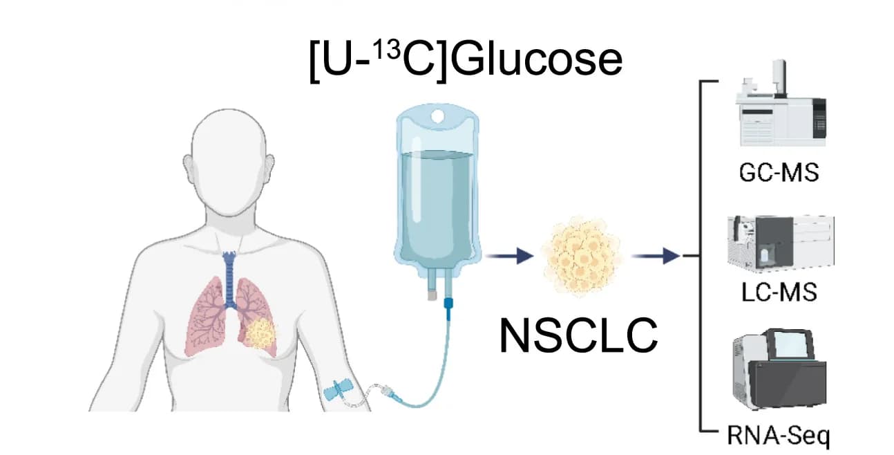 Open access visualization of Workflow, Illustration, Schematic, Glucose Infusion, NSCLC Patients