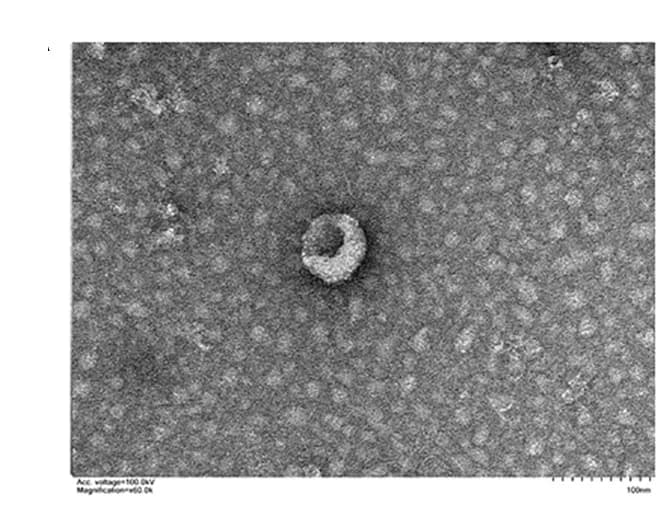 Open access visualization of Microscopy, Exosomes, MODE-K Cells, Stachyose, Electron Microscopy