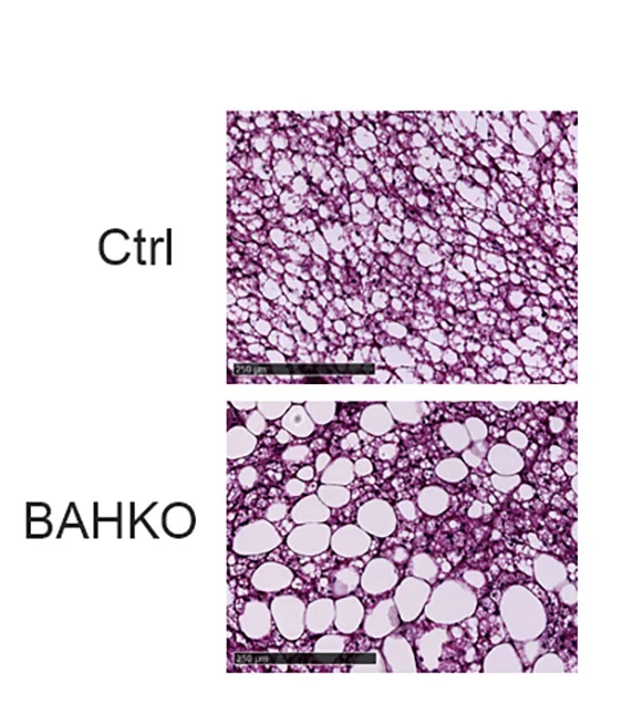 Open access visualization of Microscopy, Hematoxylin/Eosin Staining, Interscapular BAT Sections, Control Mice, BAHKO Mice