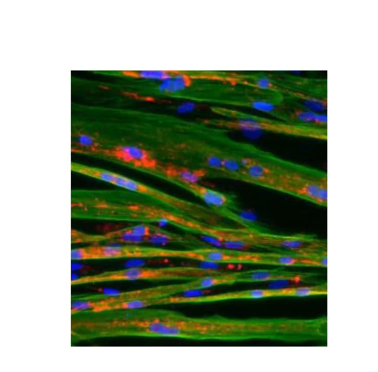 Open access visualization of Microscopy, Human Myoblasts, Myotubes, Immunostaining, Fibers