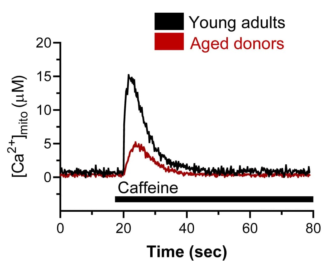 Open access visualization of Line Plot, mtCa2+ Traces, Myotubes, Young Donors, Aged Donors