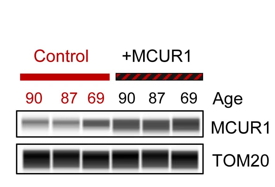 Open access visualization of Gel, MCUR1 Protein Expression, Human Myotubes, Aged Donors, Adenoviral Overexpression