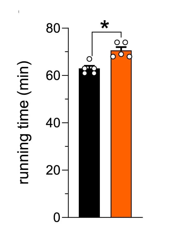 Open access visualization of Bar Plot, Error Bars, mRNA Expression Levels, MCU Complex Genes, Tibialis Anterior Muscles