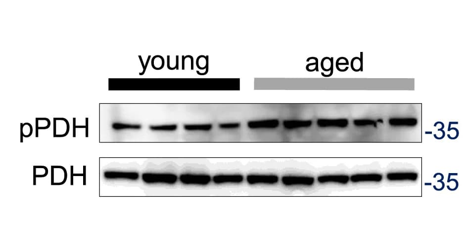 Open access visualization of Gel, PDH Phosphorylation Levels, Western Blot, Aged Tibialis Anterior Muscles, Aged Mice