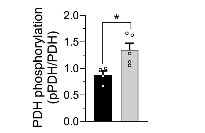 Open access visualization of Bar Plot, Error Bars, PDH Phosphorylation Levels, Western Blot, Aged Tibialis Anterior Muscles
