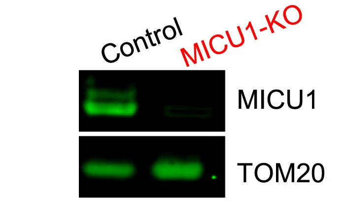 Open access visualization of Gel, Aequorin, mtCa2+ Uptake, MCU Knockdown, Human Myotubes