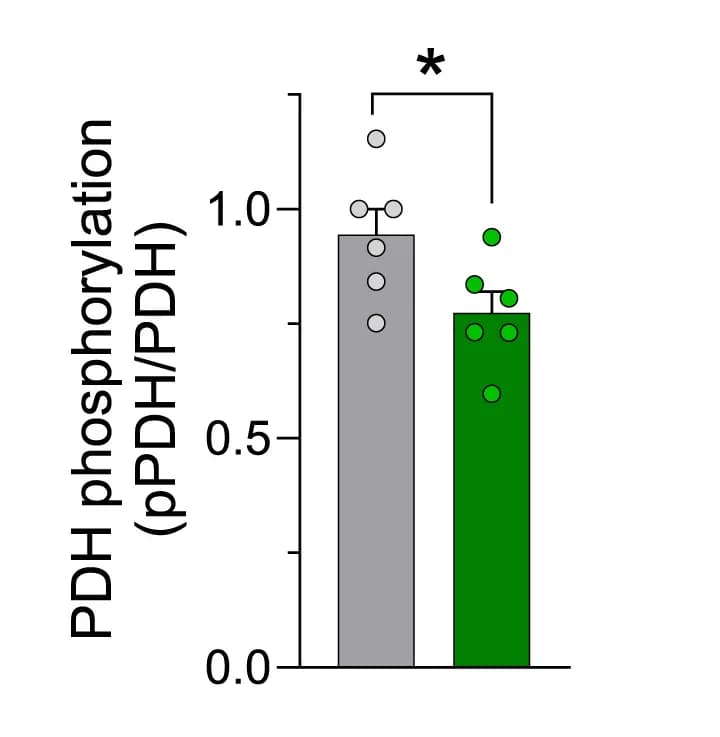 Open access visualization of Bar Plot, Error Bars, PDH Phosphorylation, PDH Activity, Tibialis Anterior Muscle