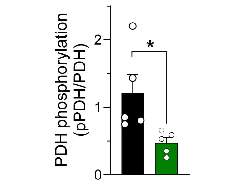 Open access visualization of Bar Plot, Error Bars, PDH Activation, Western Blot, Gastrocnemius Muscle