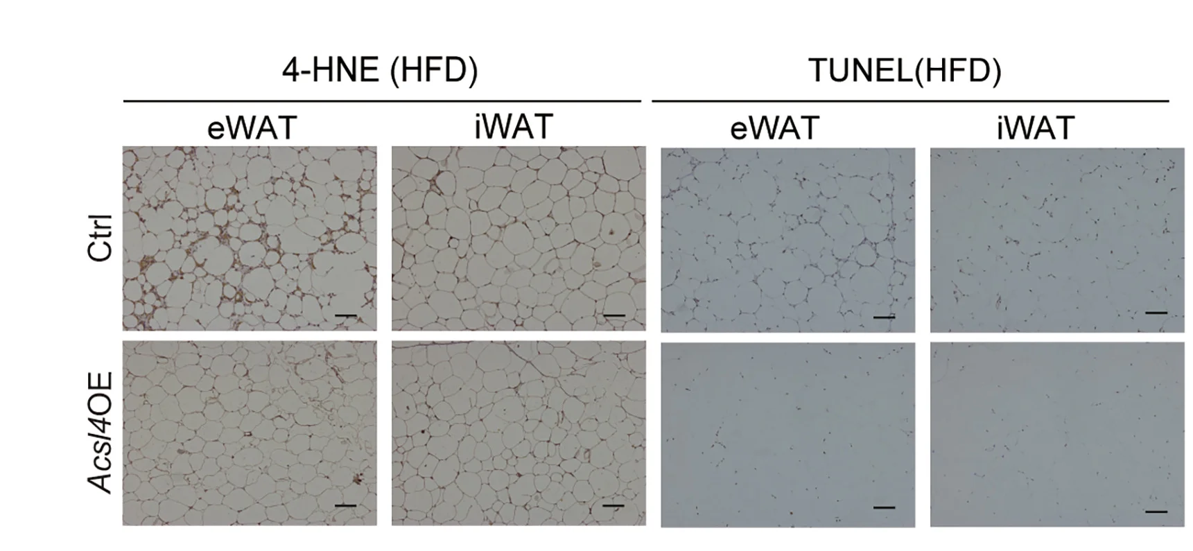 Open access visualization of Microscopy, eWAT, iWAT, HFD-fed Acsl4OE Mice, Ctrl Mice