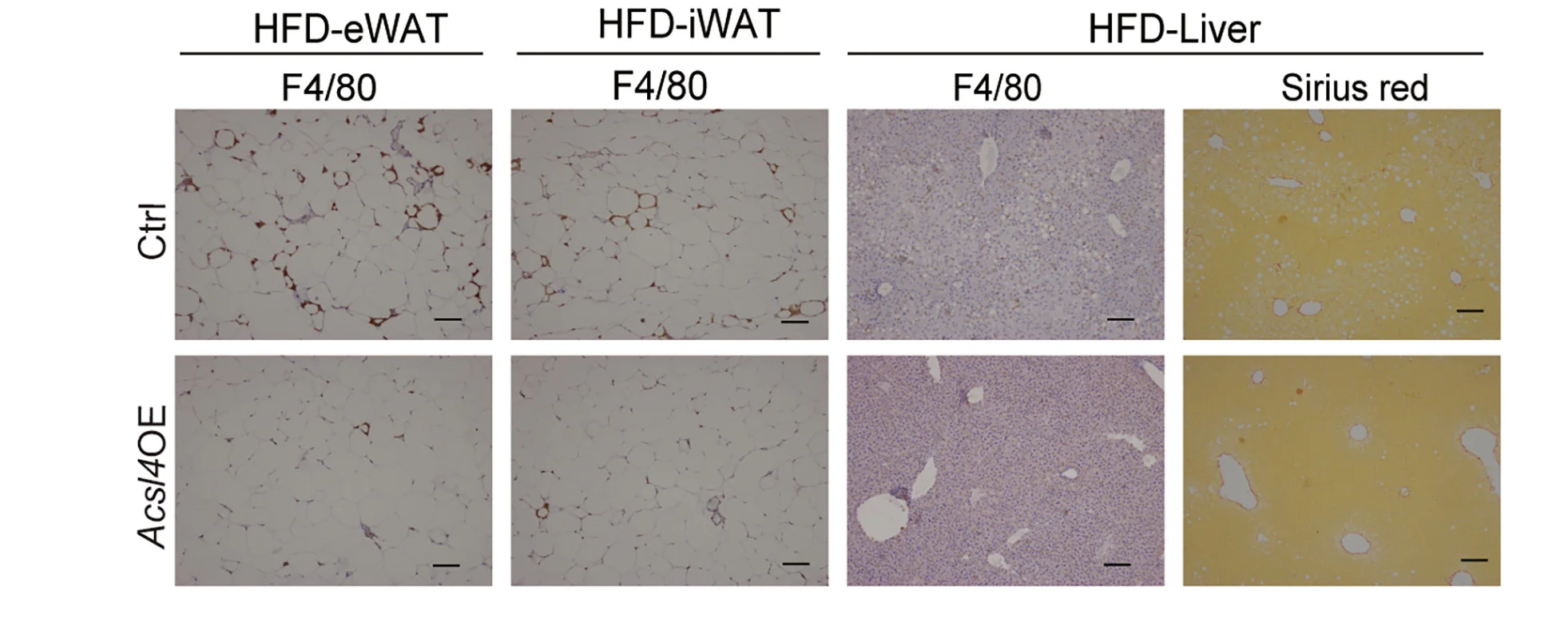 Open access visualization of Microscopy, F4/80, eWAT, HFD-fed Acsl4OE Mice, Control Mice